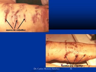 Dr. Carlos Moreno Sánchez 36
 