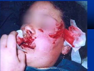 Dr. Carlos Moreno Sánchez 37
 