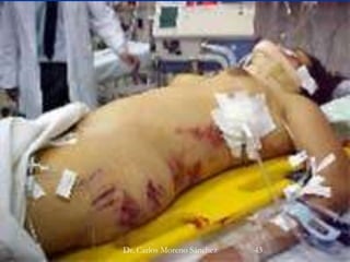 Dra. Marlene Mendoza NavarroDr. Carlos Moreno Sánchez 43
 