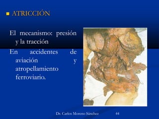 El mecanismo: presión
y la tracción
En accidentes de
aviación y
atropellamiento
ferroviario.
 ATRICCIÓN
Dr. Carlos Moreno Sánchez 44
 