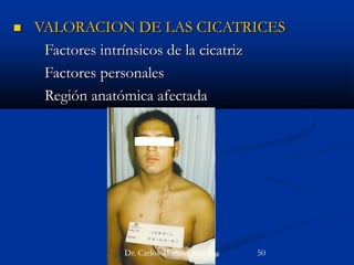 Dra. Marlene Mendoza Navarro
 VALORACION DE LAS CICATRICES
Factores intrínsicos de la cicatriz
Factores personales
Región anatómica afectada
Dr. Carlos Moreno Sánchez 50
 