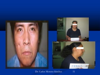 Dr. Carlos Moreno Sánchez 51
 