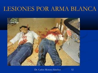 LESIONES POR ARMA BLANCA
Dr. Carlos Moreno Sánchez 52
 