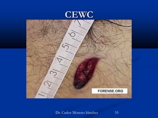 CEWC
Dr. Carlos Moreno Sánchez 55
 