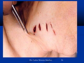 Dr. Carlos Moreno Sánchez 56
 