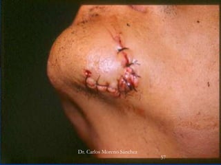 Dr. Carlos Moreno Sánchez
57
 