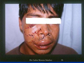 Dra. Marlene Mendoza NavarroDr. Carlos Moreno Sánchez 58
 