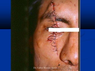 Dr. Carlos Moreno Sánchez 59
 