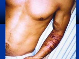 Dr. Carlos Moreno Sánchez
60
 