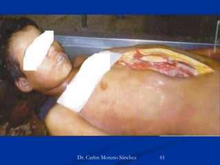 Dr. Carlos Moreno Sánchez 61
 