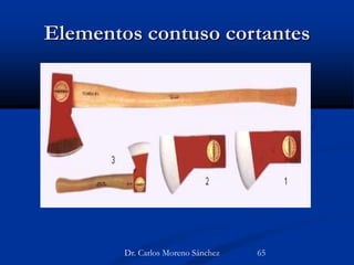 Elementos contuso cortantes
Dr. Carlos Moreno Sánchez 65
 