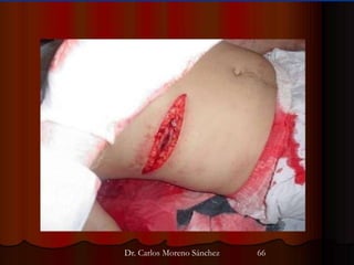 Dr. Carlos Moreno Sánchez 66
 