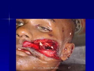 Dr. Carlos Moreno Sánchez 67
 