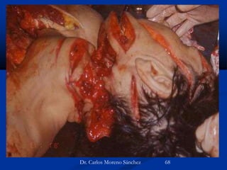 Dr. Carlos Moreno Sánchez 68
 