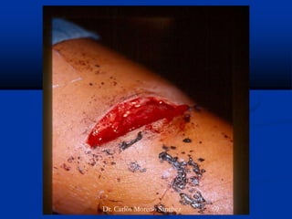 |Dr. Carlos Moreno Sánchez 69
 