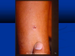 Dr. Carlos Moreno Sánchez 75
 