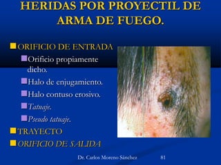 HERIDAS POR PROYECTIL DE
ARMA DE FUEGO.
ORIFICIO DE ENTRADA
Orificio propiamente
dicho.
Halo de enjugamiento.
Halo contuso erosivo.
Tatuaje.
Pseudo tatuaje.
TRAYECTO
ORIFICIO DE SALIDA
Dr. Carlos Moreno Sánchez 81
 