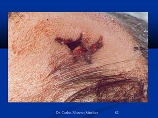 Dr. Carlos Moreno Sánchez 82
 