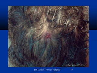 Dr. Carlos Moreno Sánchez 83
 