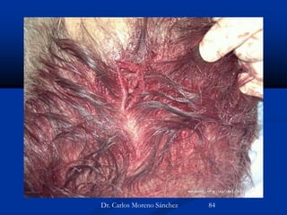 Dr. Carlos Moreno Sánchez 84
 