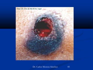 Dr. Carlos Moreno Sánchez 85
 