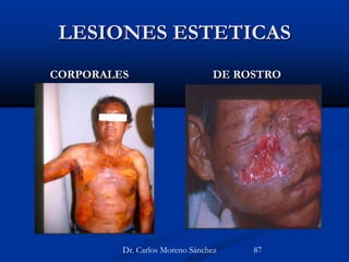 LESIONES ESTETICAS
CORPORALES DE ROSTRO
Dr. Carlos Moreno Sánchez 87
 