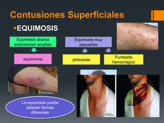 Lesionologia | PPTX