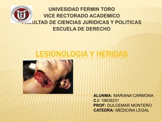 LESIONOLOGIA Y HERIDAS
UNIVESIDAD FERMIN TORO
VICE RECTORADO ACADEMICO
FACULTAD DE CIENCIAS JURIDICAS Y POLITICAS
ESCUELA DE DERECHO
ALUNMA: MARIANA CARMONA
C.I: 19639231
PROF: DULCEMAR MONTERO
CATEDRA: MEDICINA LEGAL
 