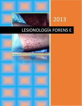 1-1-2013
0
2013
LESIONOLOGÍA FORENS E
 