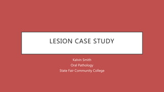 LESION CASE STUDY
Kalvin Smith
Oral Pathology
State Fair Community College
 