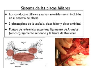 Sistema de las placas hiliares 
• Los conductos biliares y ramas arteriales están incluidas 
en el sistema de placas 
• 3 placas: placa de la vesícula, placa hiliar y placa umbilical 
• Puntos de referencia externos: ligamento de Arantius 
(venoso), ligamento redondo y la fisura de Rouviere 
11 
 