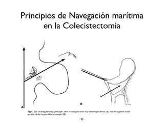 Principios de Navegación marítima 
en la Colecistectomia 
35 
 