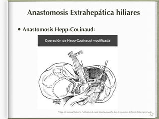 Anastomosis Extrahepática hiliares 
• Anastomosis Hepp-Couinaud: 
*Hepp J.,Couinaud L’abord et l’utilisation du canal hépatique gauche dans la reparation de la voie biliaire principale. 
67 
 