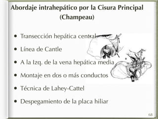 Abordaje intrahepático por la Cisura Principal 
(Champeau) 
• Transección hepática central 
• Línea de Cantle 
• A la Izq. de la vena hepática media 
• Montaje en dos o más conductos 
• Técnica de Lahey-Cattel 
• Despegamiento de la placa hiliar 
68 
 