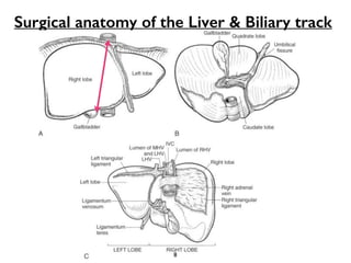 Surgical anatomy of the Liver & Biliary track 
8 
 