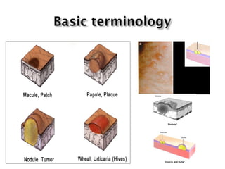 Lesionig Lesions | PPT