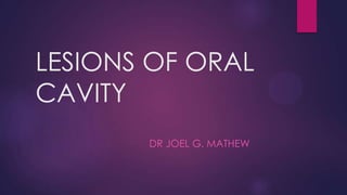 LESIONS OF ORAL
CAVITY
DR JOEL G. MATHEW
 