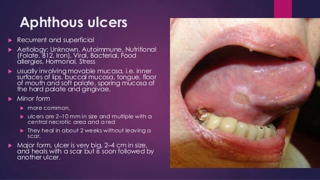 mouth for solution sores of Lesions oral cavity