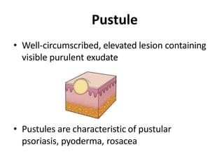 Purulent Pyoderma lesions and abrasions.pptx
