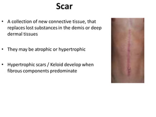 lesions and abrasions.pptx