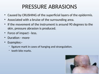 Lesions and Abrasions, Alopecia, Dermatitis and Eczema.pptx