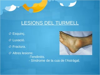 LESIONS DEL TURMELL Esquinç. Luxació. Fractura. Altres lesions:  -Tendinitis. - Síndrome de la cua de l’Astràgal. 