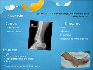 Luxació Els ossos d’una articulació queden fora de la seva posició normal. Causes: Símptomes: Tractament: - Traumatisme. - Moviment brusc. - Dolor - Inflamació - Deformació - Incapacitat de moure el turmell Gel.  Correcció de la luxació.  Immobilització amb una fèrula.  - Repòs.  Temps de recuperació: de 3 a 6 mesos 
