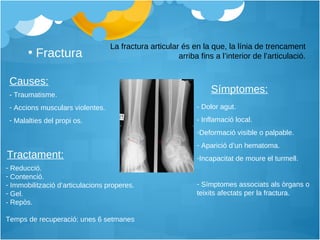 Fractura La fractura articular és en la que, la línia de trencament arriba fins a l’interior de l’articulació. Causes: Símptomes: Tractament: - Traumatisme. Accions musculars violentes. Malalties del propi os. - Dolor agut. - Inflamació local. Deformació visible o palpable. Aparició d’un hematoma. Incapacitat de moure el turmell. Símptomes associats als òrgans o teixits afectats per la fractura. Reducció. Contenció. Immobilització d’articulacions properes.  Gel. - Repòs.  Temps de recuperació: unes 6 setmanes 