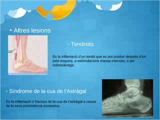 - Síndrome de la cua de l’Astràgal És la inflamació o fractura de la cua de l’astràgal a causa de la seva prominència excessiva. - Tendinitis Altres lesions És la inflamació d’un tendó que es pot produir després d’un petit esquinç, a estimulacions massa intenses, o per sobrecàrrega. 