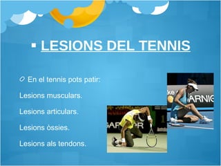 En el tennis pots patir: Lesions musculars. Lesions articulars. Lesions òssies.  Lesions als tendons.  LESIONS DEL TENNIS 