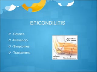 EPICONDILITIS   -Causes. -Prevenció. -Símptomes. -Tractament.  