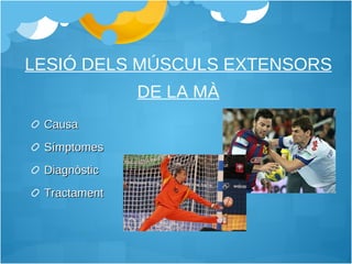 LESIÓ DELS MÚSCULS EXTENSORS DE LA MÀ Causa Símptomes Diagnòstic Tractament 