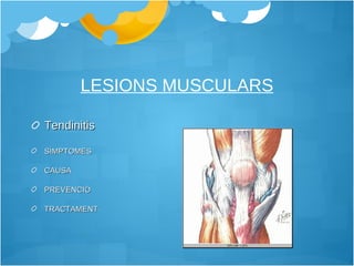 LESIONS MUSCULARS Tendinitis SÍMPTOMES CAUSA PREVENCIÓ TRACTAMENT 