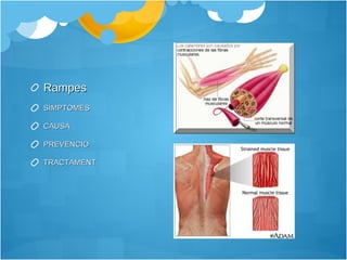 Rampes SÍMPTOMES CAUSA PREVENCIÓ TRACTAMENT 